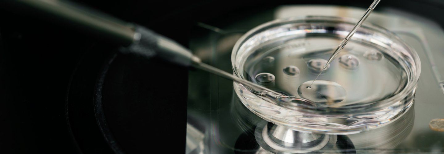 La ponction des ovocytes