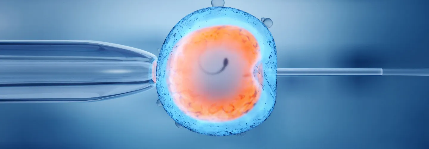 Facteurs influant sur le coût des traitements de fécondation in vitro