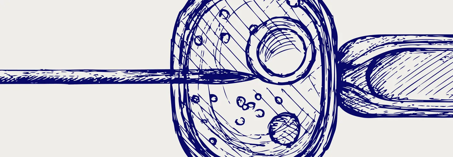 Comprendre l'infertilité féminine dans le contexte des traitements par FIV